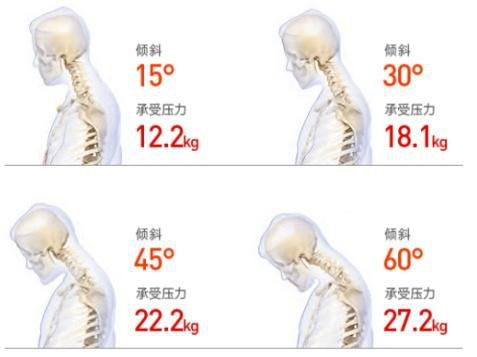 頸椎僵硬怎么辦？三步告別頸椎煩惱