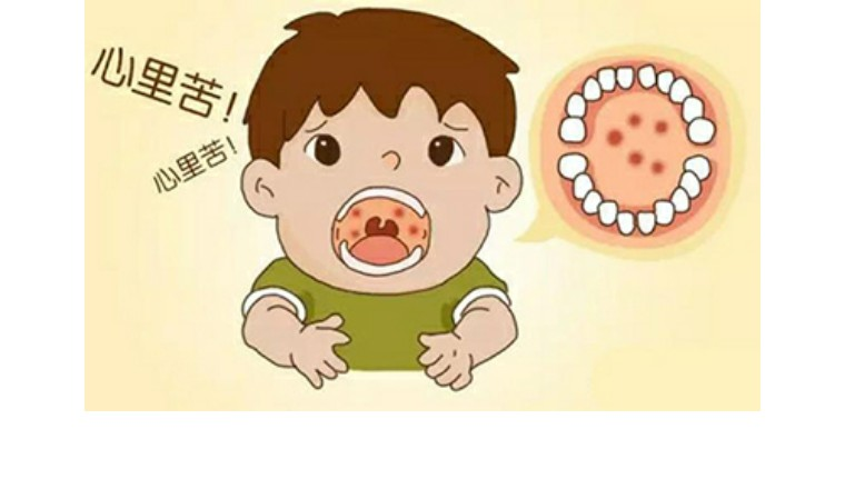 皰疹性咽峽炎高發(fā)，這些知識(shí)要了解！